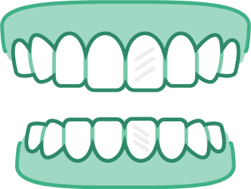 Aligner